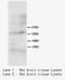 SMAD Family Member 4 antibody, LS-C171270, Lifespan Biosciences, Western Blot image 