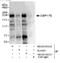 Centrosomal Protein 170 antibody, NB100-55317, Novus Biologicals, Immunoprecipitation image 