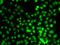 Lysine Methyltransferase 5A antibody, abx005512, Abbexa, Western Blot image 