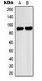 Patatin Like Phospholipase Domain Containing 8 antibody, orb224096, Biorbyt, Western Blot image 