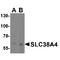 Sodium-coupled neutral amino acid transporter 4 antibody, TA349200, Origene, Western Blot image 