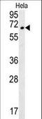 Transmembrane Protein 214 antibody, LS-B10233, Lifespan Biosciences, Western Blot image 