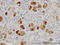 RAB43, Member RAS Oncogene Family antibody, LS-C133853, Lifespan Biosciences, Immunohistochemistry paraffin image 