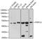 P2Y purinoceptor 12 antibody, A1710, ABclonal Technology, Western Blot image 