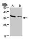 Actin Related Protein 2/3 Complex Subunit 2 antibody, PA5-21405, Invitrogen Antibodies, Western Blot image 