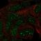 TRNA Methyltransferase 11 Homolog antibody, PA5-65067, Invitrogen Antibodies, Immunofluorescence image 