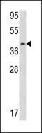 Calponin 3 antibody, 62-339, ProSci, Western Blot image 