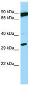 Proteasome Subunit Beta 11 antibody, TA334356, Origene, Western Blot image 