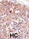 Protein Tyrosine Kinase 6 antibody, abx033641, Abbexa, Immunohistochemistry paraffin image 