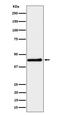 Double PHD Fingers 2 antibody, M07556-1, Boster Biological Technology, Western Blot image 
