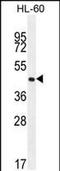 Olfactory Receptor Family 2 Subfamily F Member 2 antibody, PA5-48155, Invitrogen Antibodies, Western Blot image 