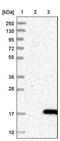 Late Endosomal/Lysosomal Adaptor, MAPK And MTOR Activator 2 antibody, PA5-52056, Invitrogen Antibodies, Western Blot image 