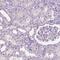 Suprabasin antibody, HPA067734, Atlas Antibodies, Immunohistochemistry paraffin image 