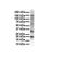 Potassium Voltage-Gated Channel Subfamily A Regulatory Beta Subunit 2 antibody, NBP1-80096, Novus Biologicals, Western Blot image 