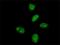Makorin Ring Finger Protein 3 antibody, H00007681-M01, Novus Biologicals, Immunocytochemistry image 