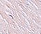 Zinc transporter ZIP2 antibody, 6083, ProSci, Immunohistochemistry paraffin image 