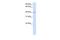 Solute Carrier Family 35 Member F6 antibody, GTX46320, GeneTex, Western Blot image 