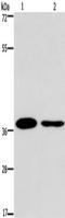 Snail Family Transcriptional Repressor 1 antibody, TA349439, Origene, Western Blot image 