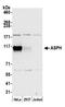 Aspartate Beta-Hydroxylase antibody, A305-343A, Bethyl Labs, Western Blot image 