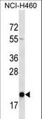 Transmembrane P24 Trafficking Protein 2 antibody, LS-C161954, Lifespan Biosciences, Western Blot image 