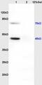 Neuronal Pentraxin 1 antibody, GTX51589, GeneTex, Western Blot image 