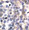 Colony Stimulating Factor 1 Receptor antibody, MA5-15151, Invitrogen Antibodies, Immunohistochemistry paraffin image 