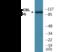 Cbl Proto-Oncogene antibody, EKC2061, Boster Biological Technology, Western Blot image 