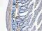 Angiopoietin Like 2 antibody, A05747-1, Boster Biological Technology, Immunohistochemistry paraffin image 