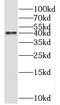 Spermine Synthase antibody, FNab08171, FineTest, Western Blot image 