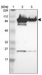 A-Kinase Anchoring Protein 8 antibody, PA5-52103, Invitrogen Antibodies, Western Blot image 