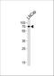 Lanosterol 14-alpha demethylase antibody, A04032-2, Boster Biological Technology, Western Blot image 