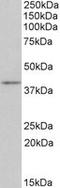 CD28 antibody, LS-C139747, Lifespan Biosciences, Western Blot image 