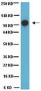 Melanoma Cell Adhesion Molecule antibody, ab24577, Abcam, Western Blot image 