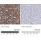 Linker For Activation Of T Cells Family Member 2 antibody, NBP1-89661, Novus Biologicals, Immunohistochemistry paraffin image 