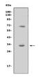 Triggering Receptor Expressed On Myeloid Cells Like 1 antibody, A07682-2, Boster Biological Technology, Western Blot image 