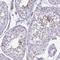 Outer Dense Fiber Of Sperm Tails 1 antibody, HPA064295, Atlas Antibodies, Immunohistochemistry paraffin image 