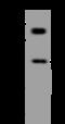 Hyperpolarization Activated Cyclic Nucleotide Gated Potassium Channel 1 antibody, 205269-T44, Sino Biological, Western Blot image 