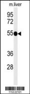 TNF Receptor Superfamily Member 8 antibody, 61-707, ProSci, Western Blot image 