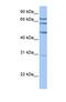 Testis Specific Serine Kinase Substrate antibody, NBP1-54878, Novus Biologicals, Western Blot image 