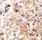BGP antibody, LS-C97648, Lifespan Biosciences, Immunohistochemistry paraffin image 