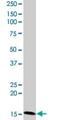 Cell Death Inducing DFFA Like Effector C antibody, ab77115, Abcam, Western Blot image 