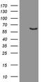 Fascin Actin-Bundling Protein 1 antibody, LS-C791174, Lifespan Biosciences, Western Blot image 