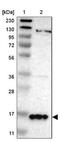 Synuclein Gamma antibody, NBP1-89996, Novus Biologicals, Western Blot image 