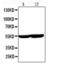 Cytochrome P450 Family 2 Subfamily E Member 1 antibody, LS-C344043, Lifespan Biosciences, Western Blot image 