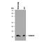 S100 Calcium Binding Protein A10 antibody, MAB2377, R&D Systems, Western Blot image 