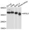 Apolipoprotein L3 antibody, LS-C748863, Lifespan Biosciences, Western Blot image 