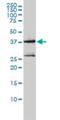 MAGE Family Member A2B antibody, H00004101-M01, Novus Biologicals, Western Blot image 