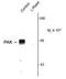 Alpha-PAK antibody, GTX82619, GeneTex, Western Blot image 