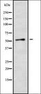 Cytochrome P450 Family 2 Subfamily A Member 6 antibody, orb336314, Biorbyt, Western Blot image 