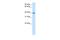 Integrin Subunit Beta 1 Binding Protein 2 antibody, A11655, Boster Biological Technology, Western Blot image 